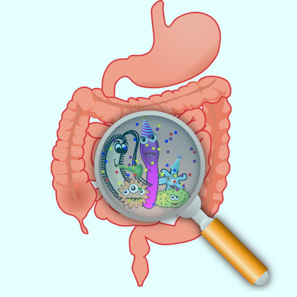 Causes of IBS: Gut microbiota