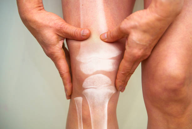 Joint pain due to inflammation